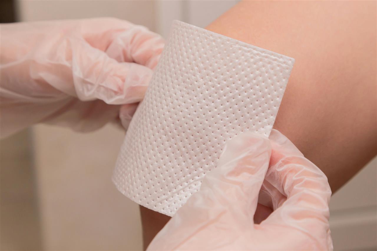 Guide til effektiv brandsårsbehandling